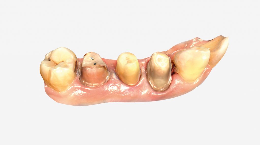 dental1