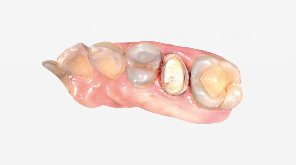 dental3