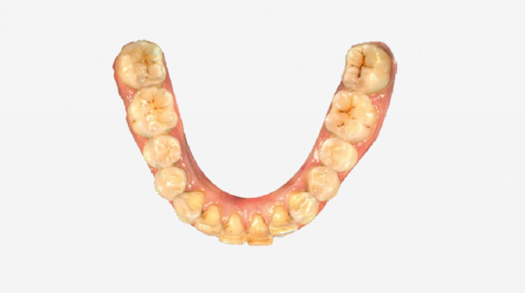 dental4
